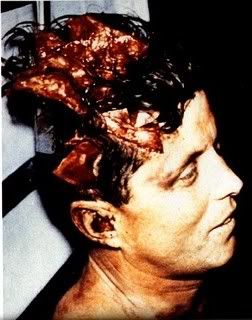 jfk_autopsy_02cf.jpg