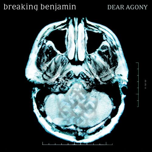 FS Breaking Benjamin - Dear Agony (2009) 320kbps FS Breaking Benjamin - Dear Agony (2009) 320kbps